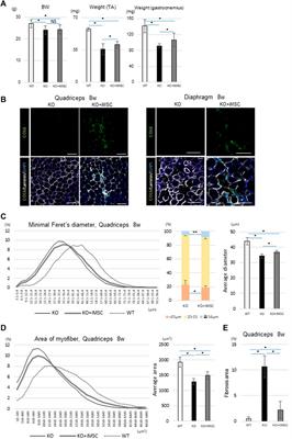 Systemic Supplementation of Collagen VI by Neonatal Transplantation of iPSC-Derived MSCs Improves Histological Phenotype and Function of Col6-Deficient Model Mice